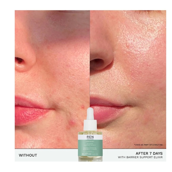 Ren Barrier Support Elixir - Picture 2 of 10